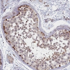 Immunohistochemical staining of human testis shows strong nuclear positivity in subset of cells in seminiferous ducts.
