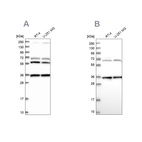 Western blot analysis using Anti-DNAJC17 antibody HPA040914 (A) shows similar pattern to independent antibody HPA041187 (B).