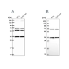 Western blot analysis using Anti-DNAJC17 antibody HPA040914 (A) shows similar pattern to independent antibody HPA041187 (B).
