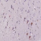 Immunohistochemical staining of human cerebral cortex shows moderate cytoplasmic positivity in subset of neuronal cells.