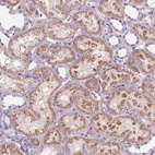Immunohistochemical staining of human kidney shows moderate cytoplasmic positivity in cells in tubules.