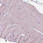 Immunohistochemical staining of human skeletal muscle shows no positivity in myocytes.