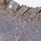 Immunohistochemical staining of human tonsil shows strong cytoplasmic membranous positivity in squamous epithelial cells.