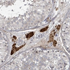 Immunohistochemical staining of human testis shows strong cytoplasmic-nucleus positivity in Leydig cells.