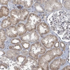 Immunohistochemical staining of human kidney shows moderate cytoplasmic positivity in cells in tubules.