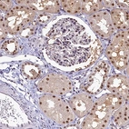 Immunohistochemical staining of human kidney shows strong nuclear positivity in cells in tubules with moderate cytoplasmic positivity.