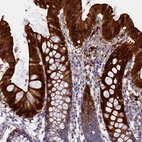 Immunohistochemical staining of human colon shows strong cytoplasmic positivity in glandular cells.