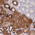 Immunohistochemical staining of human kidney shows strong cytoplasmic positivity in cells in tubules.