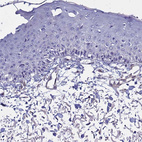 Immunohistochemical staining of human skin shows no positivity in squamous epithelial cells as expected.