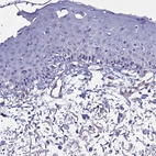 Immunohistochemical staining of human skin shows no positivity in squamous epithelial cells as expected.