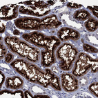 Immunohistochemical staining of human kidney shows strong membranous-cytoplasmic positivity in cells in tubules.