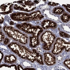 Immunohistochemical staining of human kidney shows strong membranous-cytoplasmic positivity in cells in tubules.