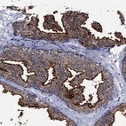 Immunohistochemical staining of human prostate shows strong membranous-cytoplasmic positivity in glandular cells.