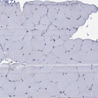 Immunohistochemical staining of human skeletal muscle shows no positivity in myocytes.