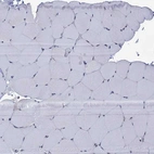 Immunohistochemical staining of human skeletal muscle shows no positivity in myocytes.