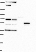 Lane 1: Marker [kDa] 250, 130, 95, 72, 55, 36, 28, 17, 10 | Lane 2: RT4 | Lane 3: U-251 MG | Lane 4: Human Plasma | Lane 5: Liver | Lane 6: Tonsil