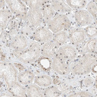 Immunohistochemical staining of human kidney shows moderate positivity in nucleoli in cells in tubules.