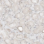 Immunohistochemical staining of human kidney shows moderate positivity in nucleoli in cells in tubules.