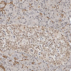Immunohistochemical staining of human pancreas shows moderate positivity in nucleoli in endocrine glandular cells and exocrine glandular cells.