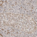 Immunohistochemical staining of human pancreas shows moderate positivity in nucleoli in endocrine glandular cells and exocrine glandular cells.
