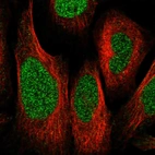 Immunofluorescent staining of human cell line U-2 OS shows localization to nucleoplasm.