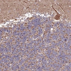 Immunohistochemical staining of human cerebellum shows moderate cytoplasmic positivity in Purkinje cells.