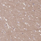 Immunohistochemical staining of human cerebral cortex shows weak cytoplasmic positivity in neuropil.