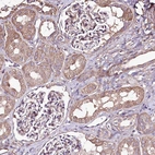 Immunohistochemical staining of human kidney shows weak cytoplasmic positivity in cells in glomeruli.