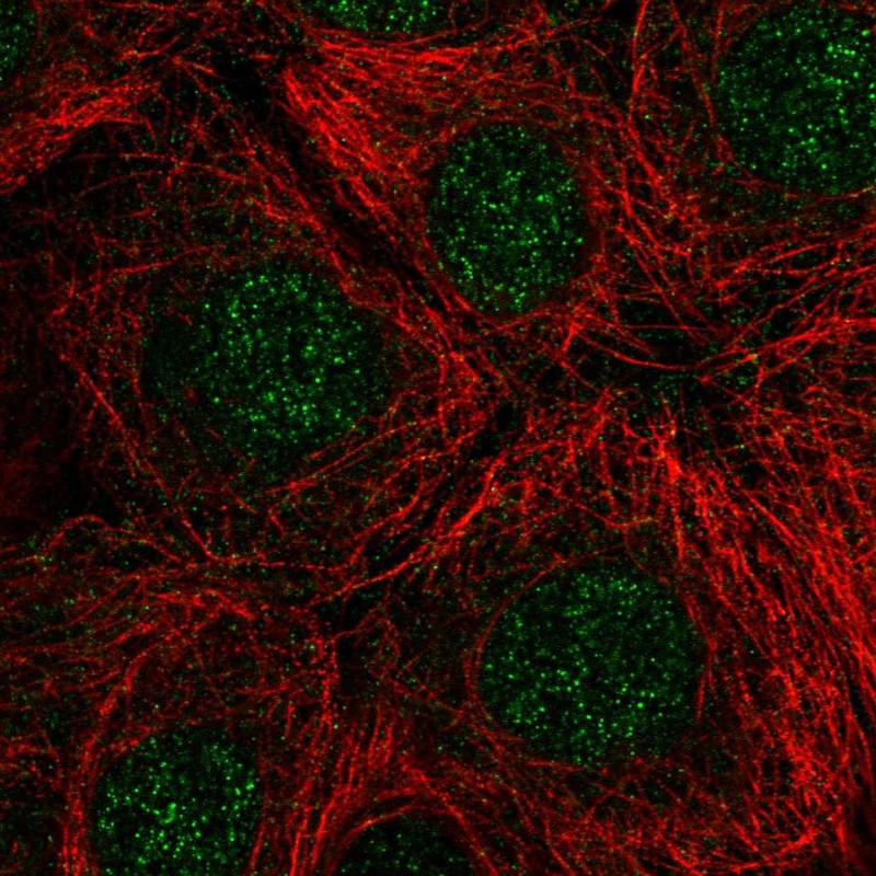 Anti-RNASEH2C Antibody