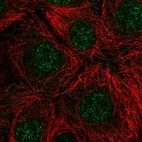 Anti-RNASEH2C Antibody