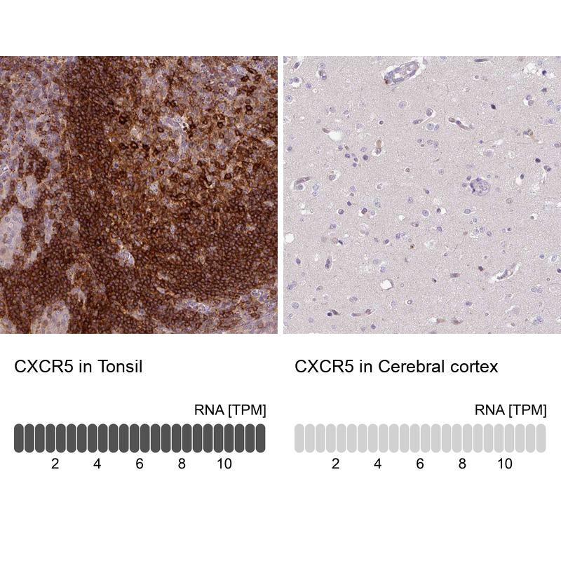 Anti-CXCR5 Antibody