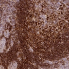 Immunohistochemical staining of human tonsil shows strong cytoplasmic positivity in germinal center cells.