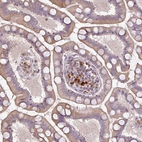 Immunohistochemical staining of human small intestine shows moderate to strong cytoplasmic positivity in lymphoid cells.