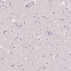 Immunohistochemical staining of human cerebral cortex shows no positivity as expected.