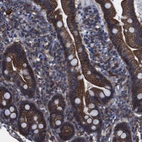 Immunohistochemical staining of human duodenum shows strong cytoplasmic and membranous positivity in glandular cells.
