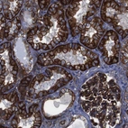 Immunohistochemical staining of human kidney shows strong cytoplasmic and membranous positivity in cells in tubules.