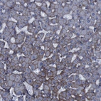 Immunohistochemical staining of human liver shows moderate membranous positivity in hepatocytes.