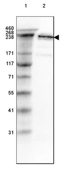 Lane 1: Marker [kDa] 460, 268, 238, 171, 117, 71, 55, 41, 31_br/_Lane 2: Human cell line A-549