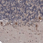 Immunohistochemical staining of human cerebellum shows moderate nuclear positivity in Purkinje cells.
