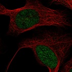 Immunofluorescent staining of human cell line U-2 OS shows localization to nucleus.