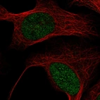 Immunofluorescent staining of human cell line U-2 OS shows localization to nucleus.