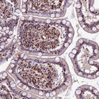 Immunohistochemical staining of human small intestine shows moderate nuclear positivity in lymphoid cells.