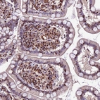 Immunohistochemical staining of human small intestine shows moderate nuclear positivity in lymphoid cells.