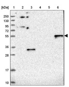 Lane 1: Marker [kDa] 250, 130, 95, 72, 55, 36, 28, 17, 10_br/_Lane 2: Human cell line RT-4_br/_Lane 3: Human cell line U-251MG sp_br/_Lane 4: Human plasma (IgG/HSA depleted)_br/_Lane 5: Human liver tissue_br/_Lane 6: Human tonsil tissue