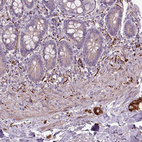 Immunohistochemical staining of human small intestine shows strong cytoplasmic positivity in peripheral nerves.