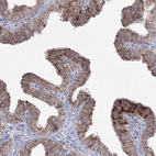 Immunohistochemical staining of human fallopian tube shows moderate cytoplasmic granular positivity in glandular cells.