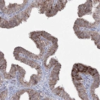 Immunohistochemical staining of human fallopian tube shows moderate cytoplasmic granular positivity in glandular cells.