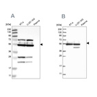 Western blot analysis using Anti-GRSF1 antibody HPA036984 (A) shows similar pattern to independent antibody HPA036985 (B).