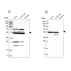 Western blot analysis using Anti-GRSF1 antibody HPA036984 (A) shows similar pattern to independent antibody HPA036985 (B).