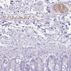 Immunohistochemical staining of human small intestine submucosa shows weak to moderate cytoplasmic positivity in erythrocytes.